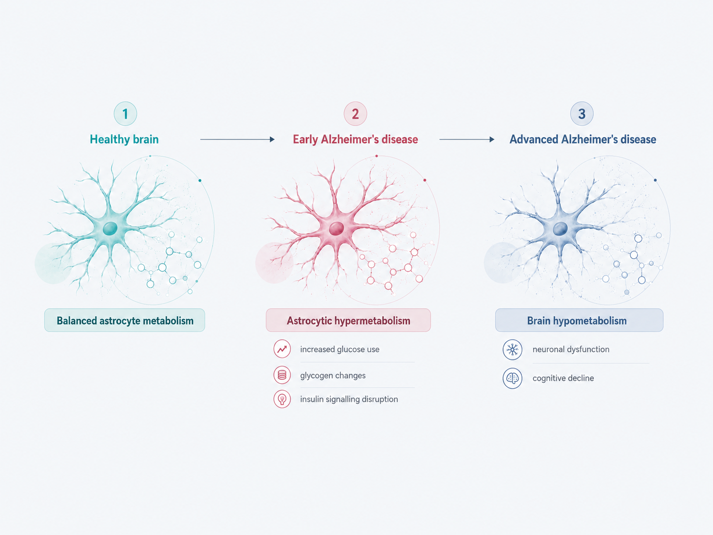 Healthy brain → Early Alzheimer's disease → Advanced Alzheimer's disease
